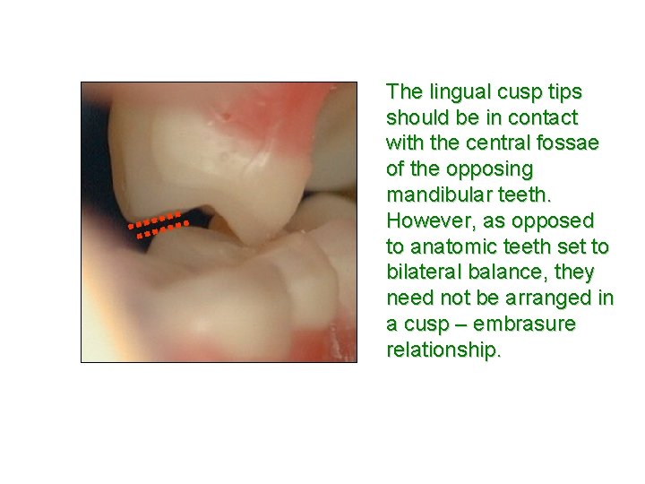 The lingual cusp tips should be in contact with the central fossae of the