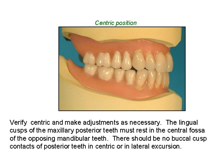 Centric position Verify centric and make adjustments as necessary. The lingual cusps of the