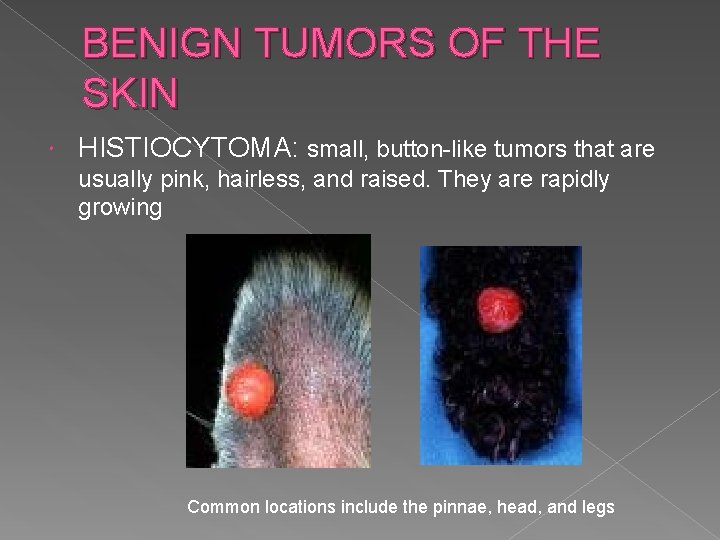 BENIGN TUMORS OF THE SKIN HISTIOCYTOMA: small, button-like tumors that are usually pink, hairless,
