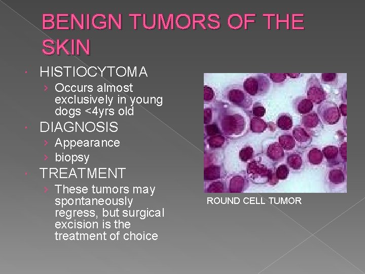 BENIGN TUMORS OF THE SKIN HISTIOCYTOMA › Occurs almost exclusively in young dogs <4