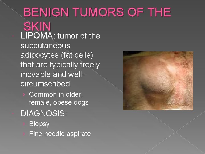  BENIGN TUMORS OF THE SKIN LIPOMA: tumor of the subcutaneous adipocytes (fat cells)