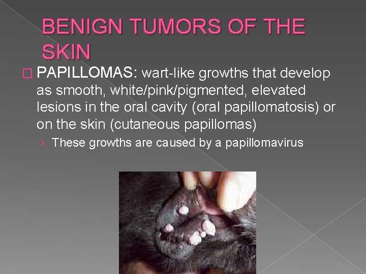 BENIGN TUMORS OF THE SKIN � PAPILLOMAS: wart-like growths that develop as smooth, white/pink/pigmented,