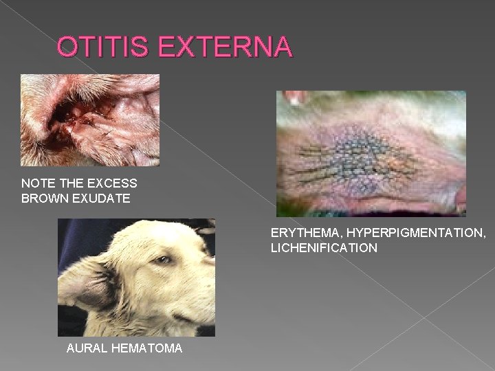 OTITIS EXTERNA NOTE THE EXCESS BROWN EXUDATE ERYTHEMA, HYPERPIGMENTATION, LICHENIFICATION AURAL HEMATOMA 