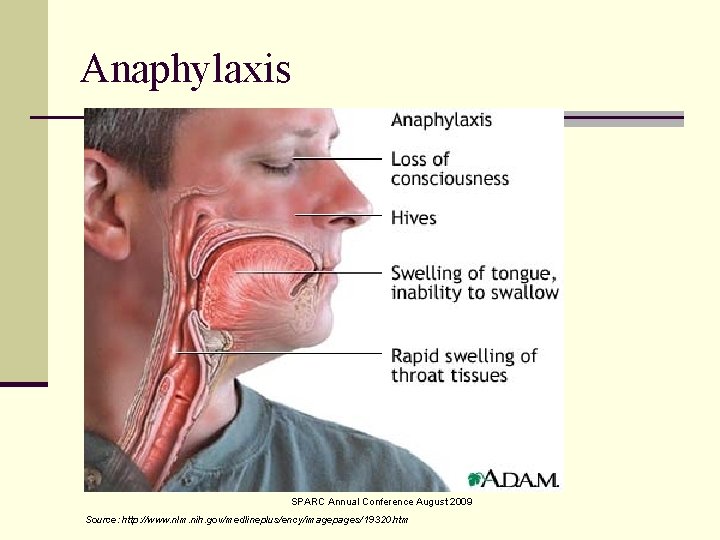 Anaphylaxis SPARC Annual Conference August 2009 Source: http: //www. nlm. nih. gov/medlineplus/ency/imagepages/19320. htm 