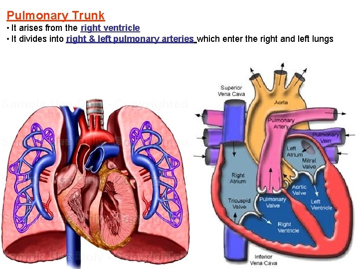 Pulmonary Trunk • It arises from the right ventricle • It divides into right