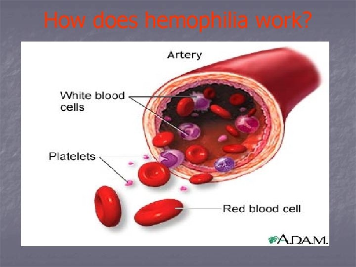 How does hemophilia work? 