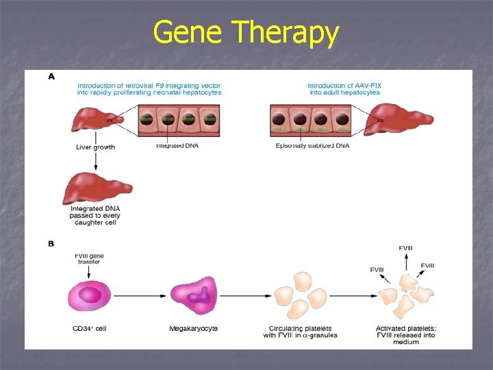 Gene Therapy 