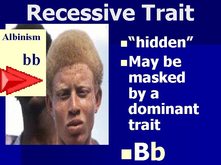 Recessive Trait Albinism bb n “hidden” n May be masked by a dominant trait