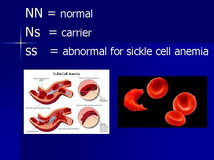 NN = normal Ns = carrier ss = abnormal for sickle cell anemia 