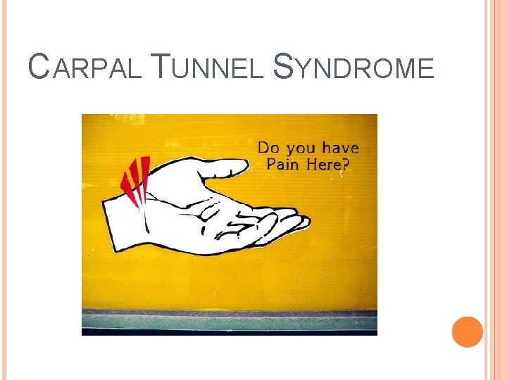 CARPAL TUNNEL SYNDROME 