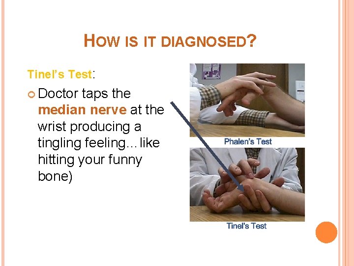 HOW IS IT DIAGNOSED? Tinel’s Test: Doctor taps the median nerve at the wrist