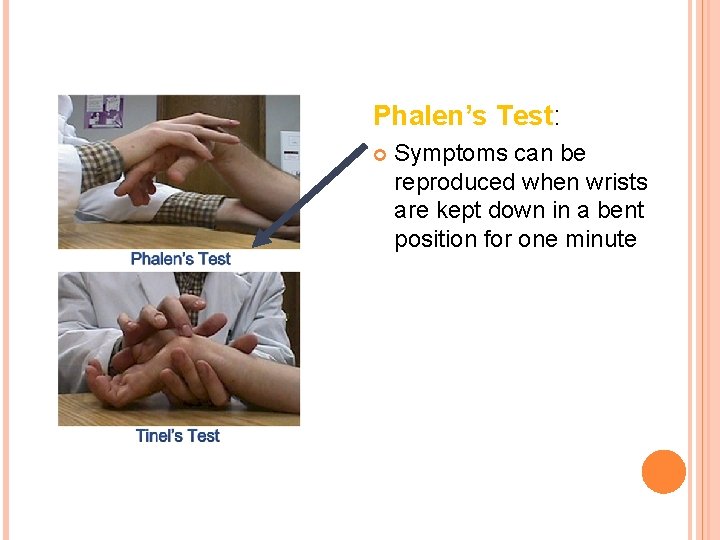 Phalen’s Test: Symptoms can be reproduced when wrists are kept down in a bent