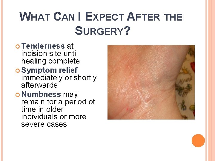 WHAT CAN I EXPECT AFTER THE SURGERY? Tenderness at incision site until healing complete