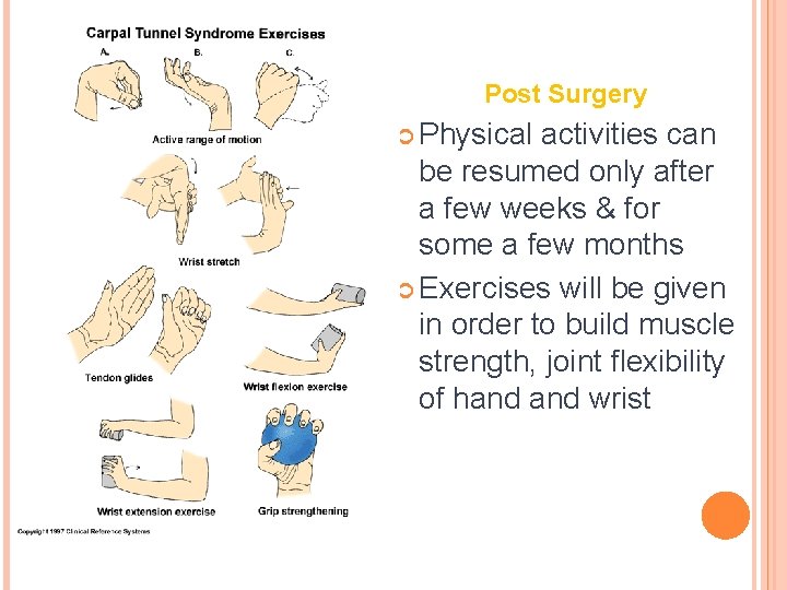 EXERCISES Post Surgery Physical activities can be resumed only after a few weeks &