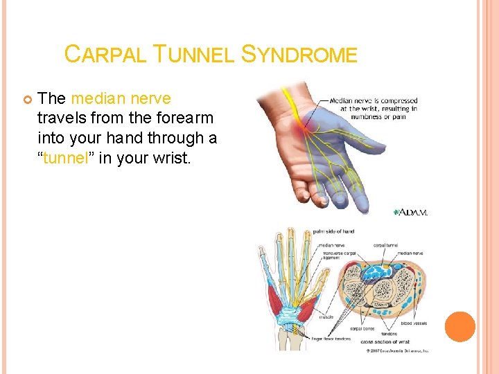 CARPAL TUNNEL SYNDROME The median nerve travels from the forearm into your hand through