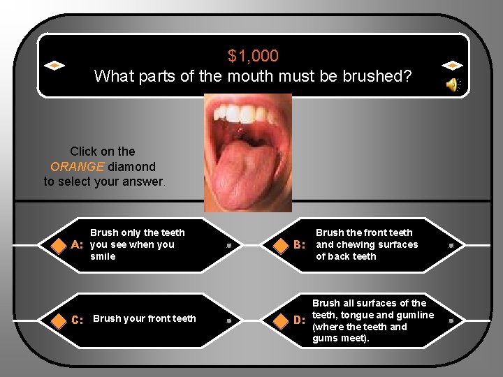 $1, 000 What parts of the mouth must be brushed? Click on the ORANGE