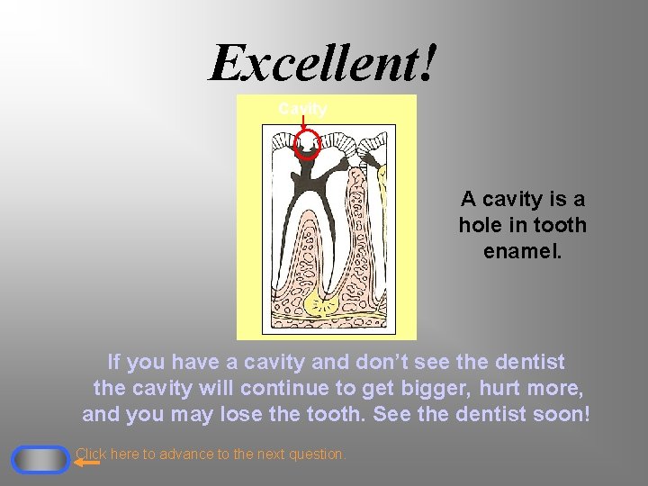 Excellent! Cavity A cavity is a hole in tooth enamel. If you have a