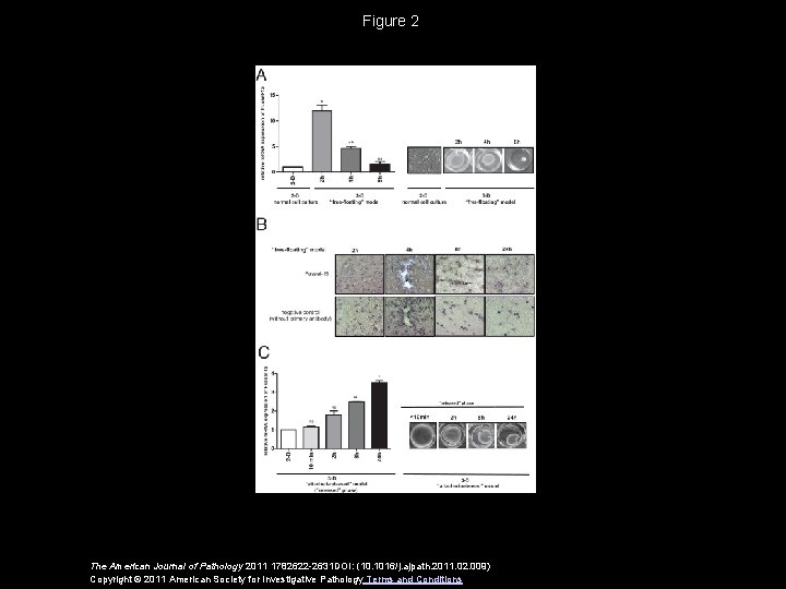 Figure 2 The American Journal of Pathology 2011 1782622 -2631 DOI: (10. 1016/j. ajpath.