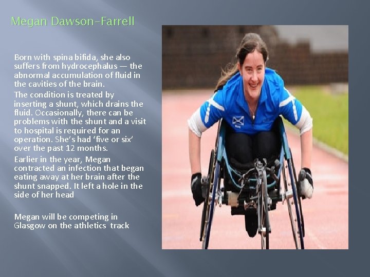 Megan Dawson-Farrell Born with spina bifida, she also suffers from hydrocephalus — the abnormal