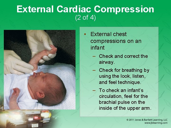 External Cardiac Compression (2 of 4) • External chest compressions on an infant –