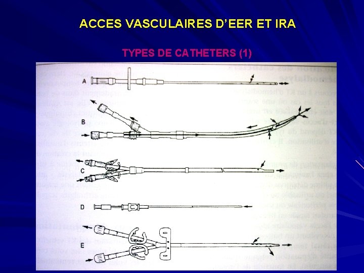 ACCES VASCULAIRES D’EER ET IRA TYPES DE CATHETERS (1) 