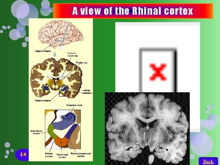 A view of the Rhinal cortex 14 Back A view of the Rhinal cortex 14 Back