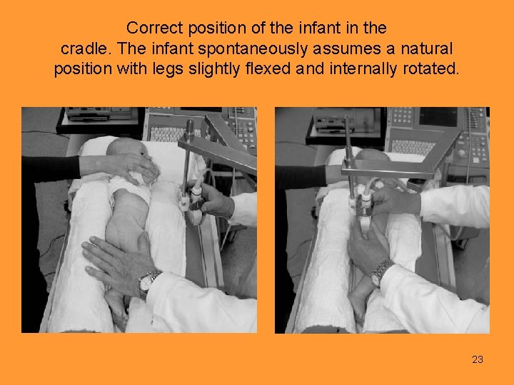 Correct position of the infant in the cradle. The infant spontaneously assumes a natural