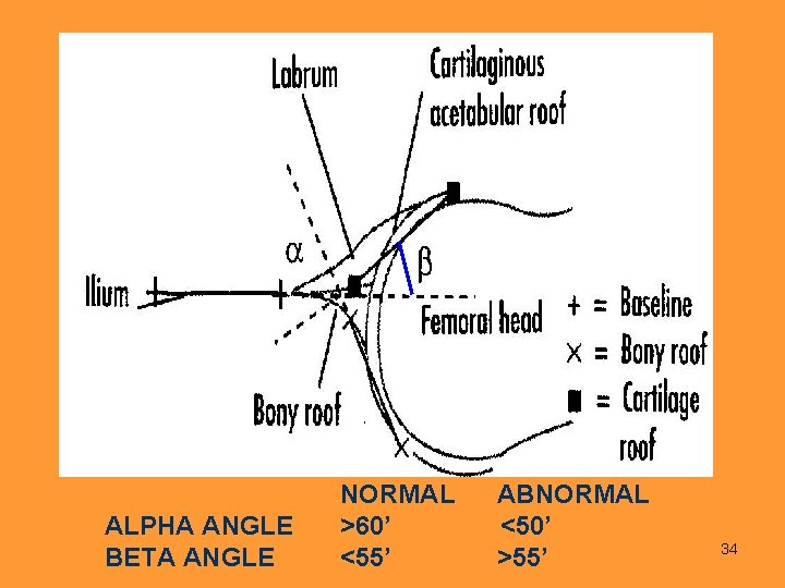 ALPHA ANGLE BETA ANGLE NORMAL ABNORMAL >60’ <50’ <55’ >55’ 34 