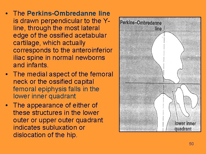  • The Perkins-Ombredanne line is drawn perpendicular to the Yline, through the most