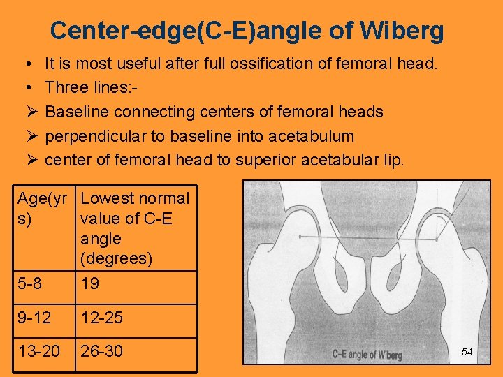 Center-edge(C-E)angle of Wiberg • • Ø Ø Ø It is most useful after full