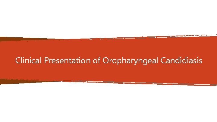 Clinical Presentation of Oropharyngeal Candidiasis Clinical Presentation of Oropharyngeal Candidiasis