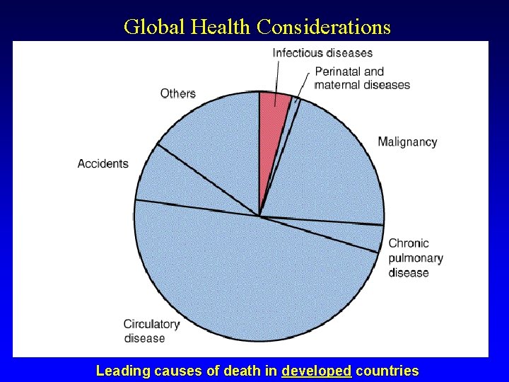 Global Health Considerations Leading causes of death in developed countries 