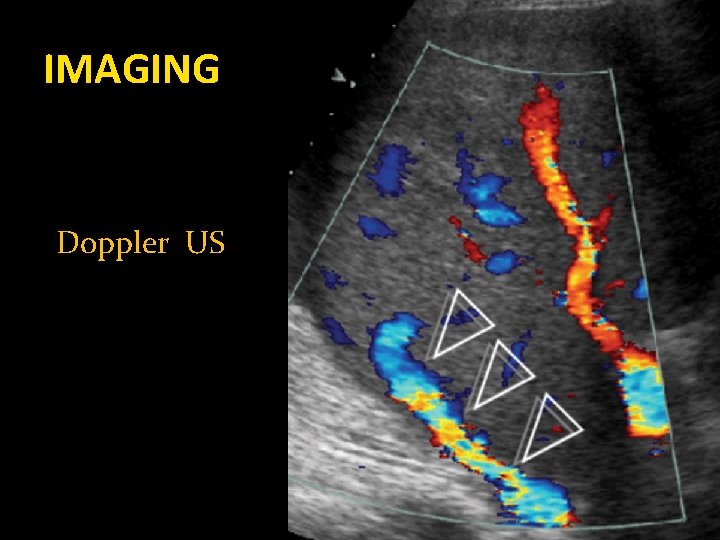 IMAGING Doppler US 