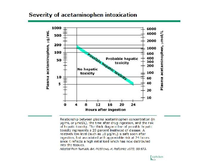 Acetaminophen Toxicity 