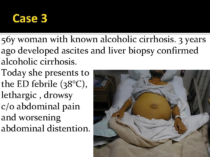 Case 3 56 y woman with known alcoholic cirrhosis. 3 years ago developed ascites