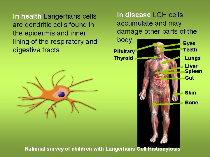 In health Langerhans cells are dendritic cells found in the epidermis and inner lining