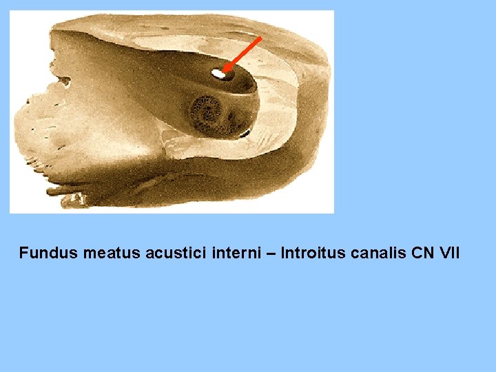 Fundus meatus acustici interni – Introitus canalis CN VII 