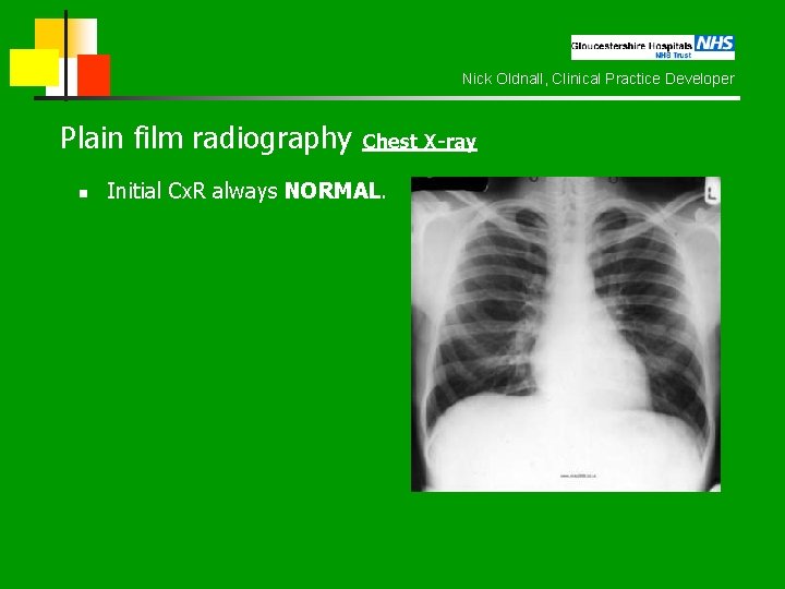 Nick Oldnall, Clinical Practice Developer Plain film radiography Chest X-ray n Initial Cx. R