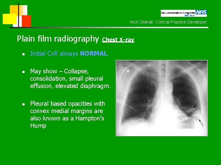 Nick Oldnall, Clinical Practice Developer Plain film radiography Chest X-ray n n n Initial