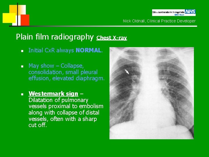 Nick Oldnall, Clinical Practice Developer Plain film radiography Chest X-ray n n n Initial