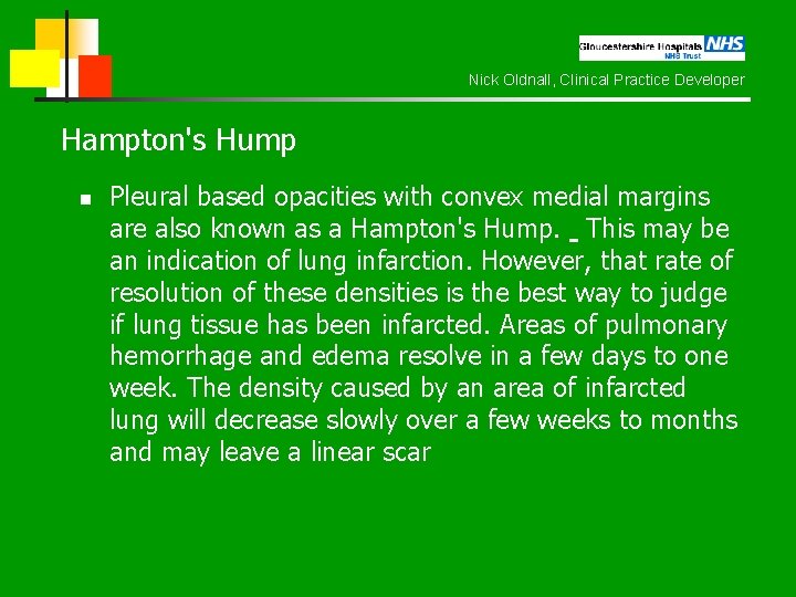 Nick Oldnall, Clinical Practice Developer Hampton's Hump n Pleural based opacities with convex medial