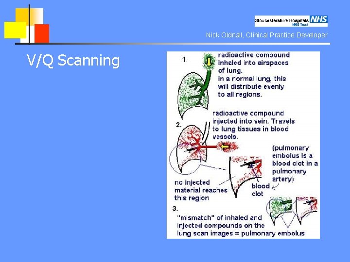 Nick Oldnall, Clinical Practice Developer V/Q Scanning 