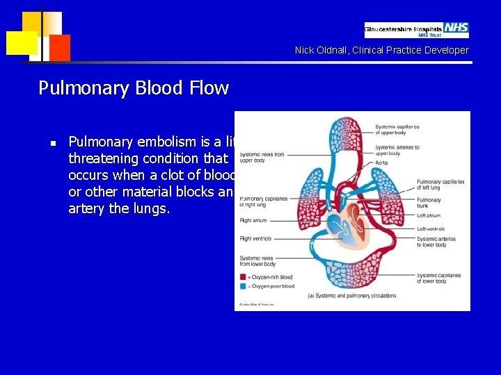 Nick Oldnall, Clinical Practice Developer Pulmonary Blood Flow n Pulmonary embolism is a lifethreatening