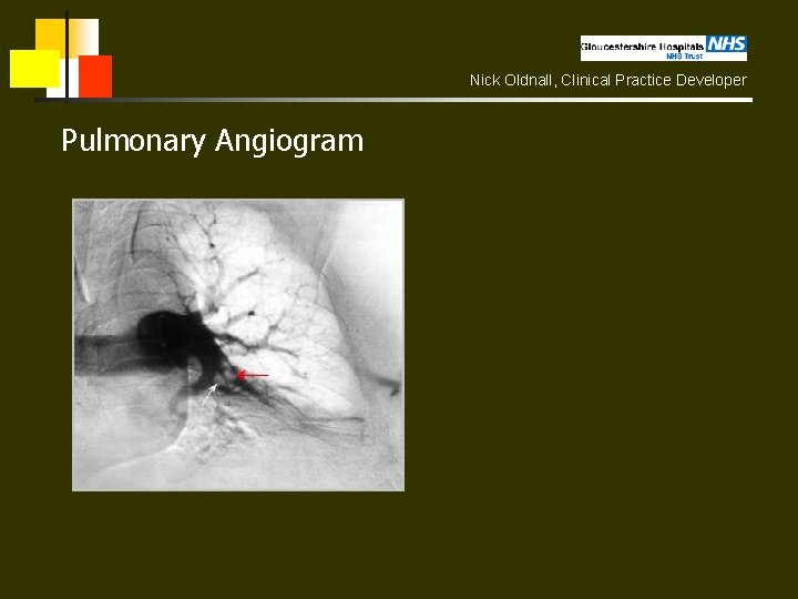 Nick Oldnall, Clinical Practice Developer Pulmonary Angiogram 