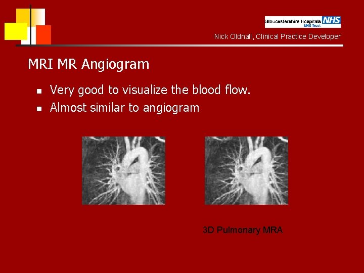 Nick Oldnall, Clinical Practice Developer MRI MR Angiogram n n Very good to visualize