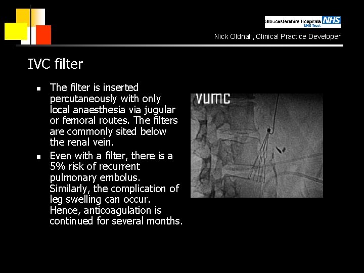 Nick Oldnall, Clinical Practice Developer IVC filter n n The filter is inserted percutaneously