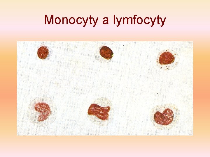 Monocyty a lymfocyty 