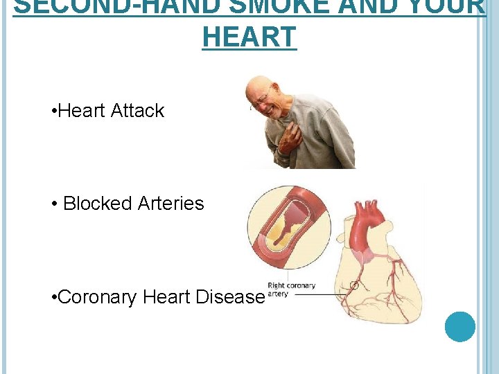 SECOND-HAND SMOKE AND YOUR HEART • Heart Attack • Blocked Arteries • Coronary Heart
