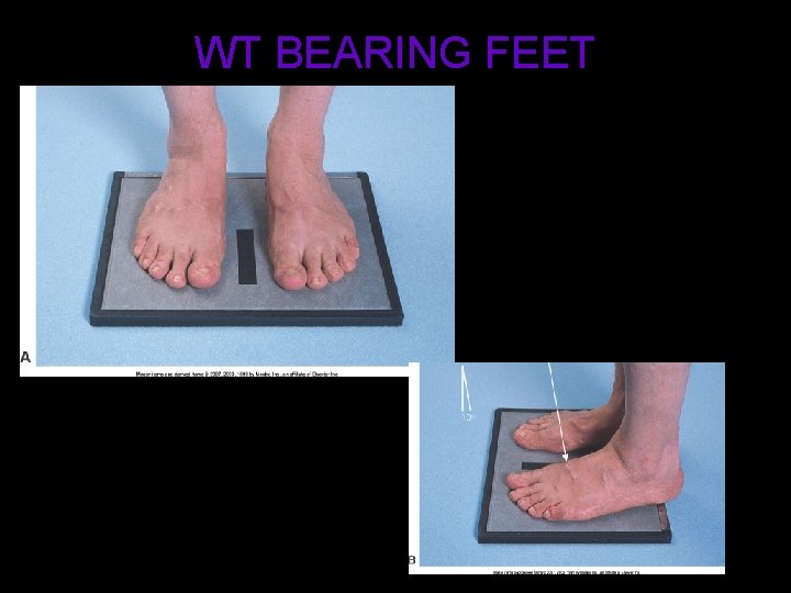 WT BEARING FEET 28 