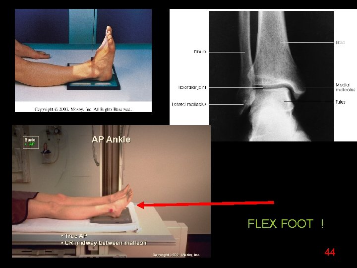 FLEX FOOT ! 44 